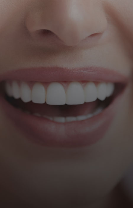 Image showing a smiling lady face with bright teeth 