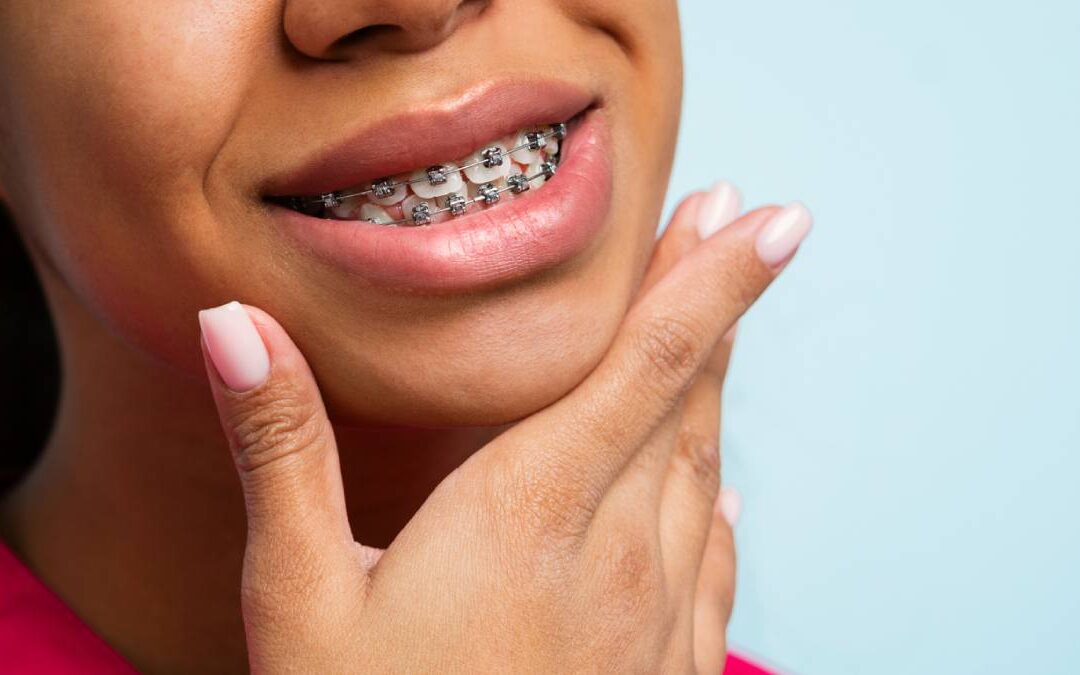 featured image for top 5 tips for the first week of braces