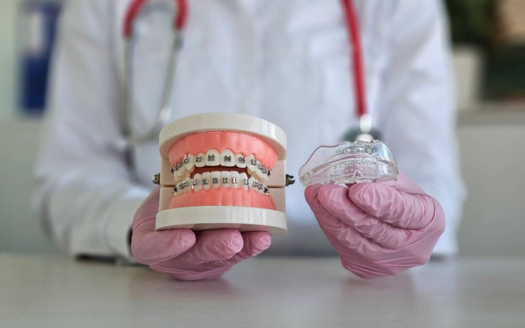 featured image for article on what does a retainer do for your teeth